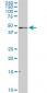 ADPGK Antibody (monoclonal) (M01)